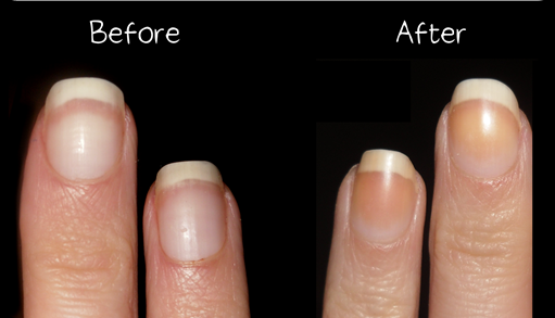 Le Petit Jardin De Liloo What Happens When You Don t Wear A Base Coat 